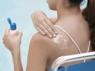 sunburn-treatment1