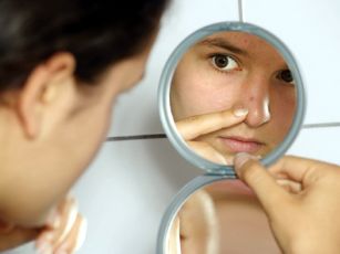 Girl-Acne-Mirror