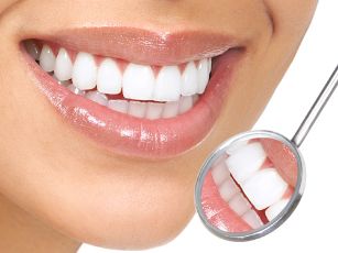 teeth-whitening-singapore